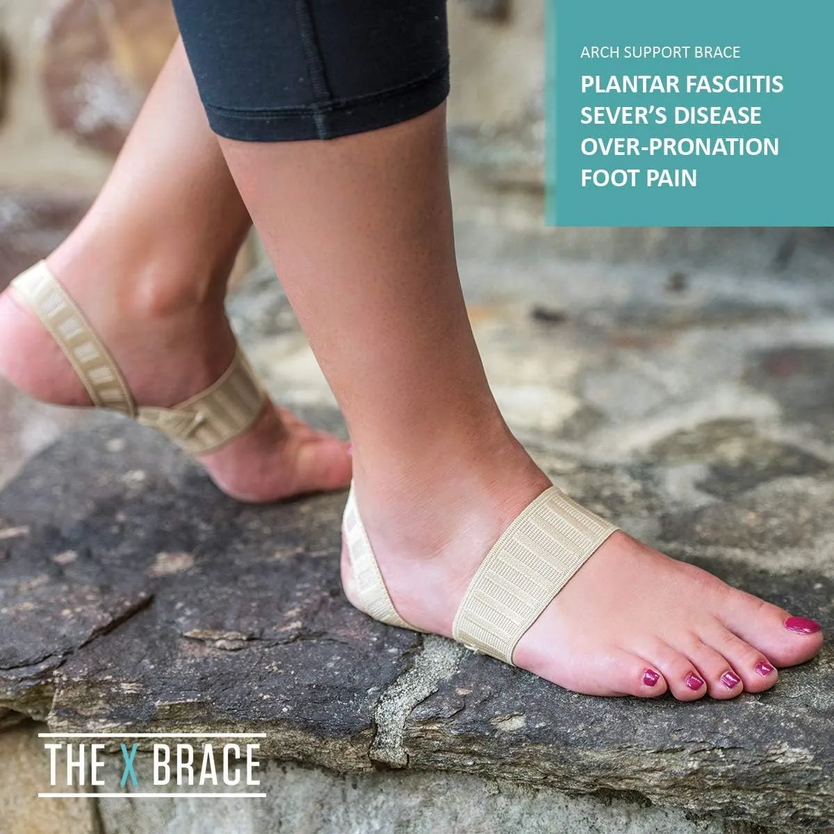 Tuli's X Brace, Arch Support Brace and Compression for Sever's Disease, Plantar Fasciitis, Heel Pain, Flat Feet, Fallen Arches, and Over-Pronation, 1 Pair, Large